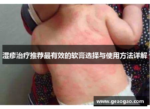 湿疹治疗推荐最有效的软膏选择与使用方法详解